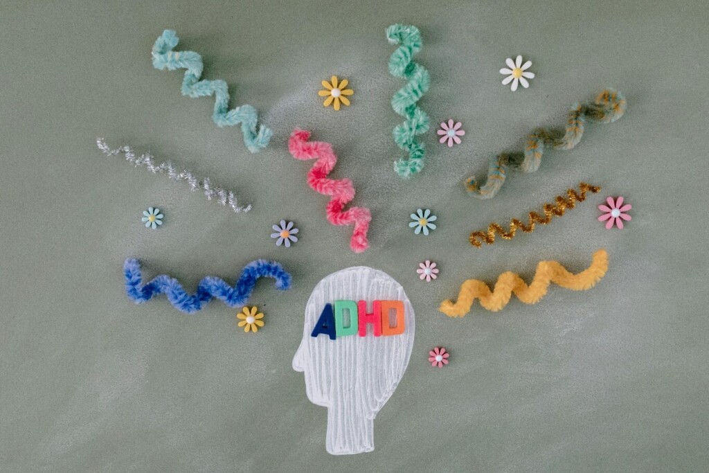 Unlocking the Power of Neurodiversity for Team Innovation